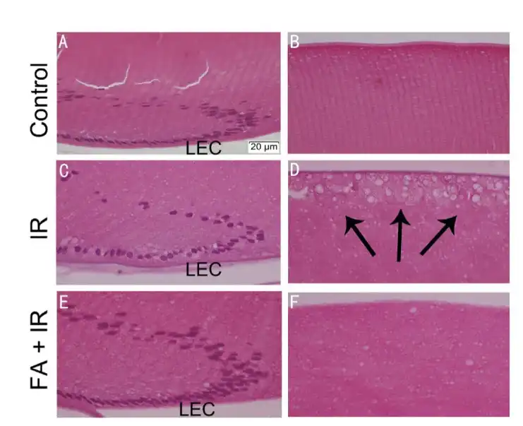 Ferulic Acid supper.jpg
